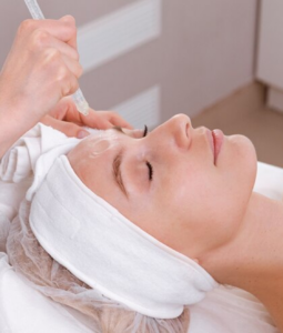 chemical peel in Washington DC