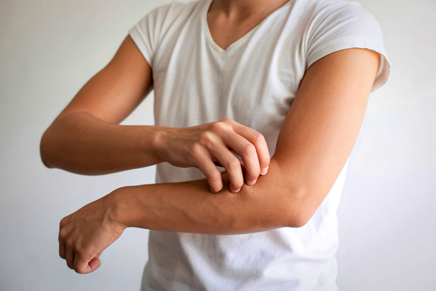 Man with dry, itchy skin before seeing a DMV dermatologist.